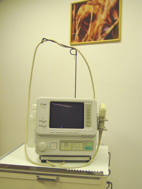 Foto - ultrazvuk